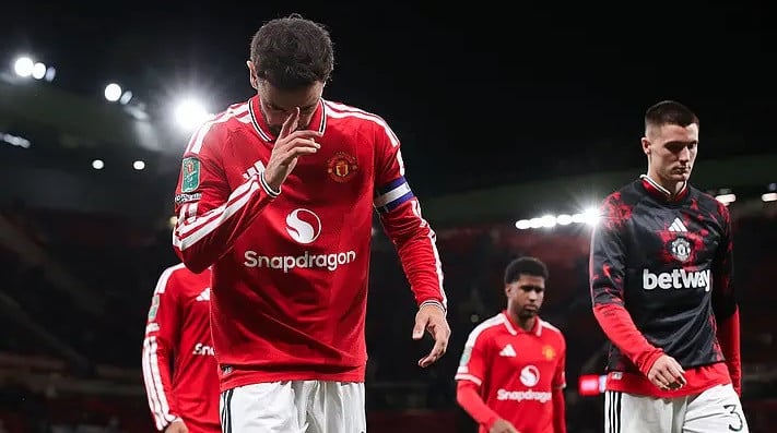 MU Tersingkir dari Piala Liga Inggris, Sempat Unggul 2-0 atas Brighton